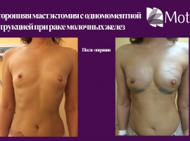 Фото Галерея